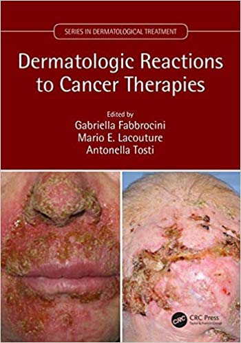 Dermatologic Reactions to Cancer Therapies 2019 - پوست
